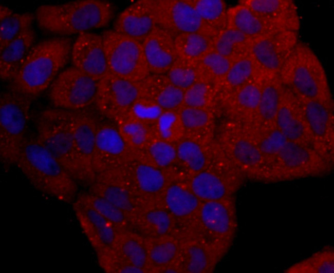 Cytokeratin 17 Antibody in Immunocytochemistry (ICC/IF)