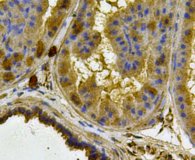 Cytokeratin 17 Antibody in Immunohistochemistry (Paraffin) (IHC (P))