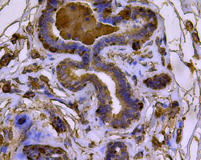 Cytokeratin 17 Antibody in Immunohistochemistry (Paraffin) (IHC (P))