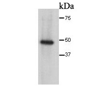 Cytokeratin 17 Antibody in Western Blot (WB)