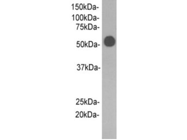 Rabbit IgG Heavy chain (Fc fragment) Antibody in Western Blot (WB)