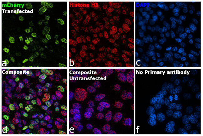 mCherry Antibody in Immunocytochemistry (ICC/IF)