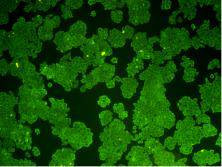 Bcl-2 Antibody in Immunocytochemistry (ICC/IF)