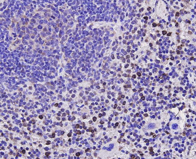 Bcl-2 Antibody in Immunohistochemistry (Paraffin) (IHC (P))