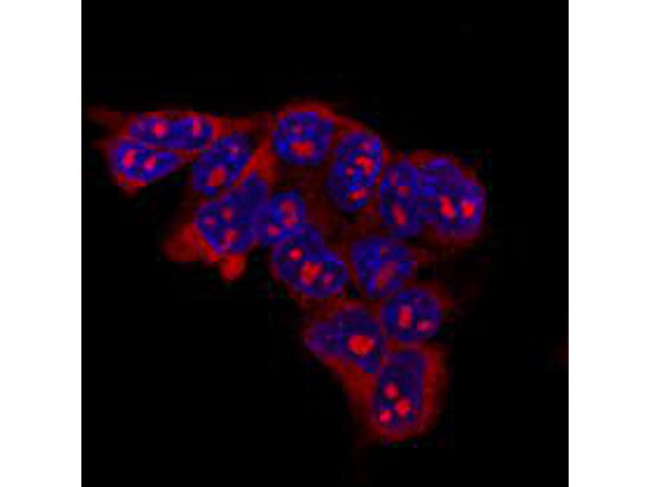 LIN28A Antibody in Immunocytochemistry (ICC/IF)