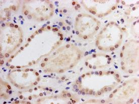 LIN28A Antibody in Immunohistochemistry (Paraffin) (IHC (P))