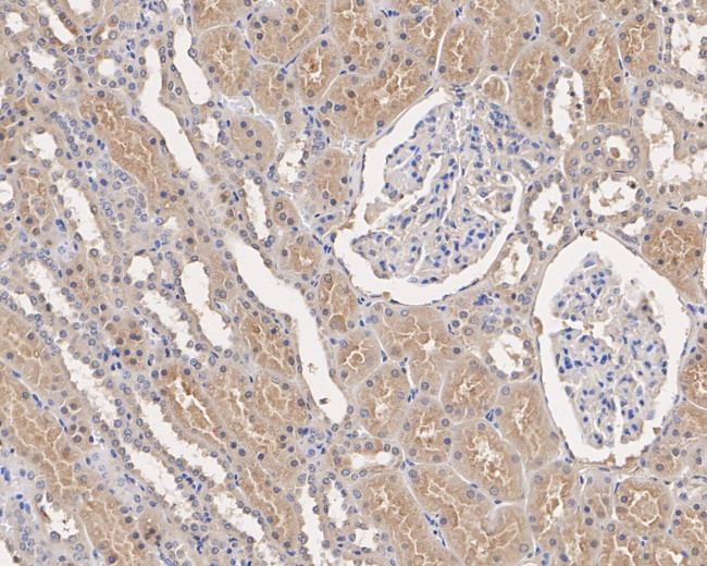 Transferrin Antibody in Immunohistochemistry (Paraffin) (IHC (P))