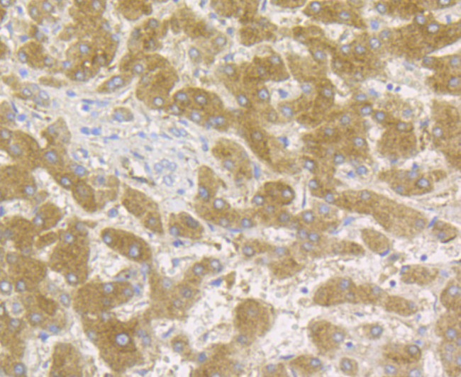 Transferrin Antibody in Immunohistochemistry (Paraffin) (IHC (P))