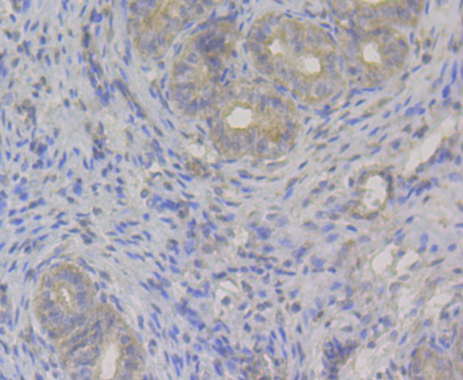 Transferrin Antibody in Immunohistochemistry (Paraffin) (IHC (P))