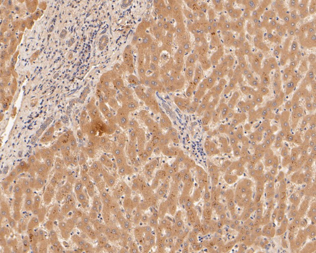 Alpha-2-macroglobulin Antibody in Immunohistochemistry (Paraffin) (IHC (P))