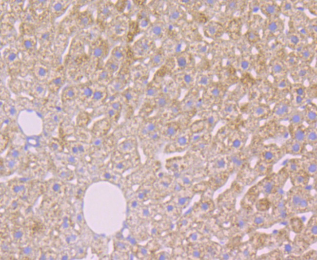 Alpha-2-macroglobulin Antibody in Immunohistochemistry (Paraffin) (IHC (P))