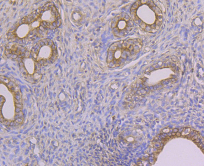 Alpha-2-macroglobulin Antibody in Immunohistochemistry (Paraffin) (IHC (P))