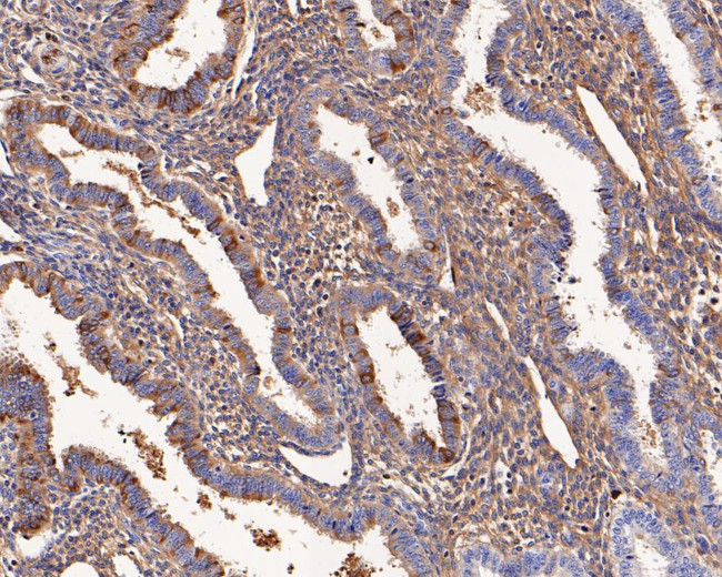 Alpha-2-macroglobulin Antibody in Immunohistochemistry (Paraffin) (IHC (P))