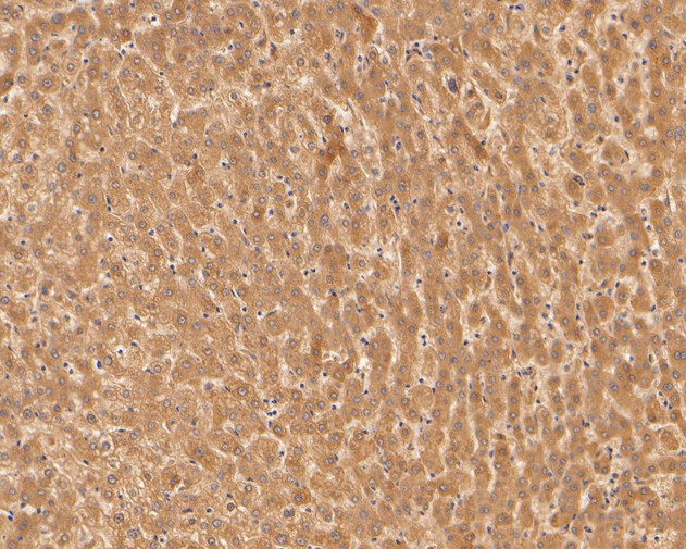 Alpha-2-macroglobulin Antibody in Immunohistochemistry (Paraffin) (IHC (P))