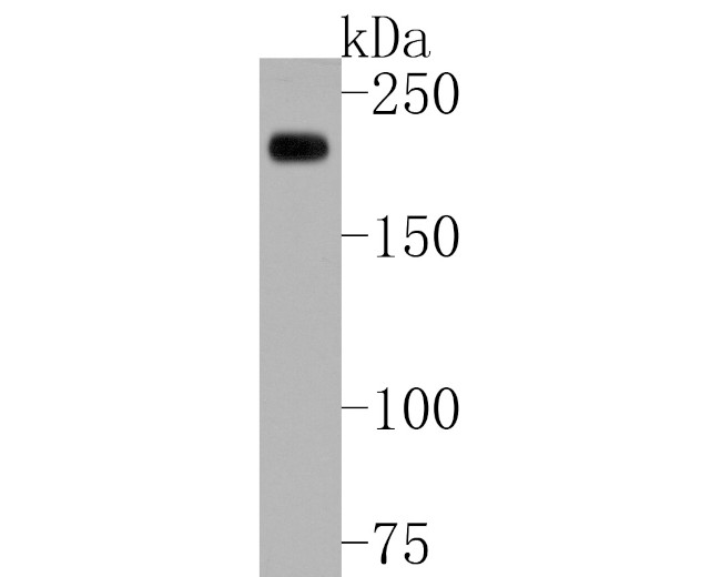 Alpha-2-macroglobulin Antibody in Western Blot (WB)