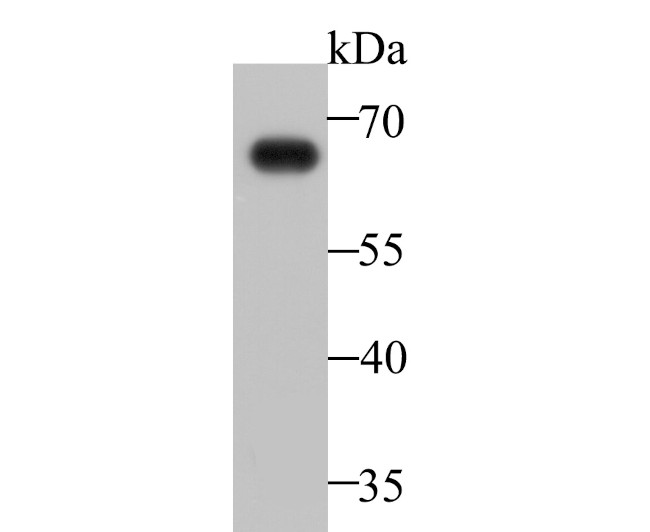 IgA Antibody in Western Blot (WB)