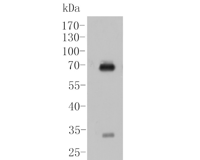 IgA Antibody in Western Blot (WB)