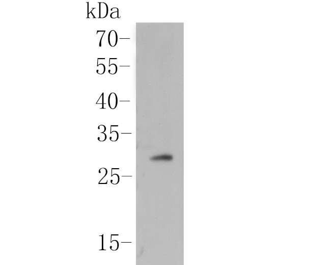 Human IgM Antibody in Western Blot (WB)