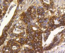 Hsp90 alpha Antibody in Immunohistochemistry (Paraffin) (IHC (P))