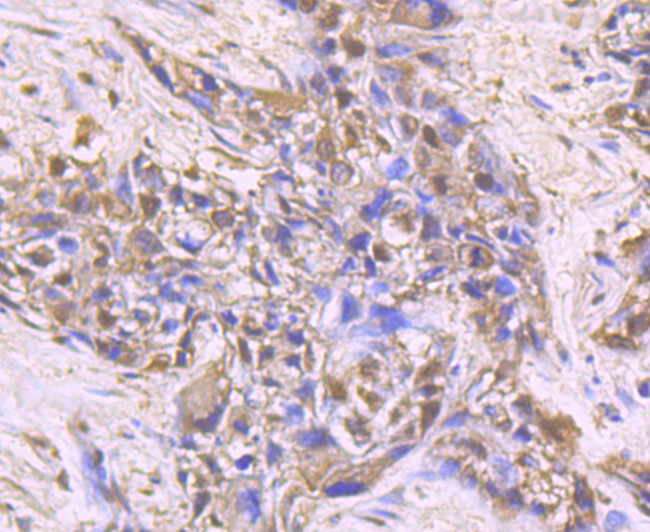 HSPA5 Antibody in Immunohistochemistry (Paraffin) (IHC (P))