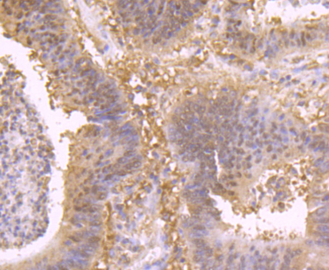 HSPA5 Antibody in Immunohistochemistry (Paraffin) (IHC (P))