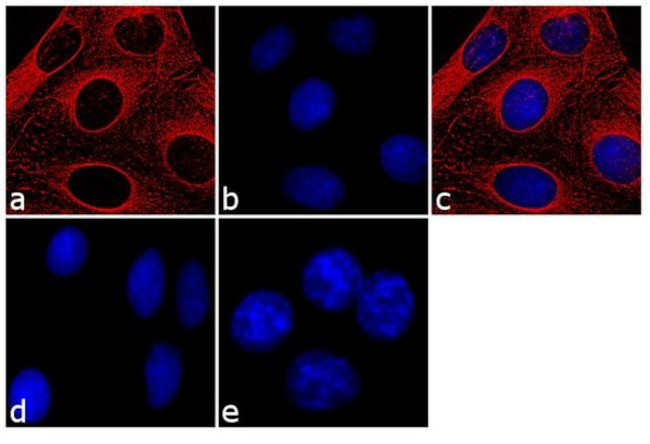 Mouse IgG (H+L) Cross-Adsorbed Secondary Antibody in Immunocytochemistry (ICC/IF)