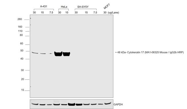 Mouse IgG2b Cross-Adsorbed Secondary Antibody in Western Blot (WB)