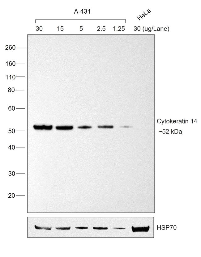 Mouse IgG3 Secondary Antibody in Western Blot (WB)
