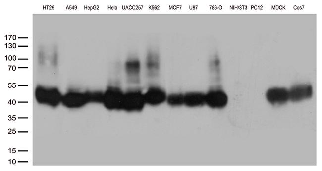 M6PR Antibody in Western Blot (WB)