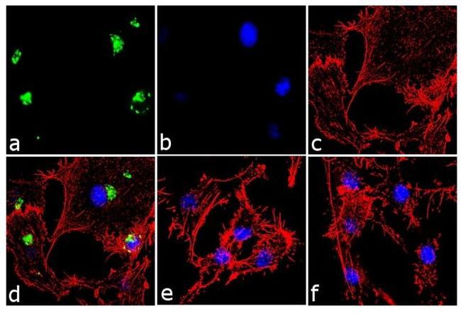 IL-8 (CXCL8) Antibody