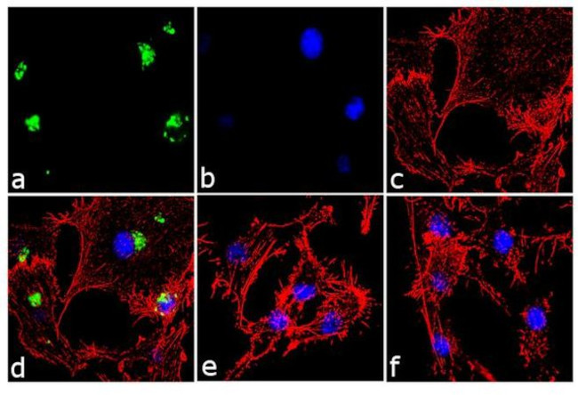 IL-8 (CXCL8) Antibody in Immunocytochemistry (ICC/IF)