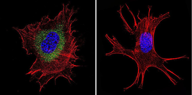 Pan Ras Antibody in Immunocytochemistry (ICC/IF)