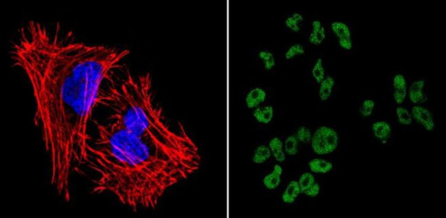 SOX2 Antibody in Immunocytochemistry (ICC/IF)