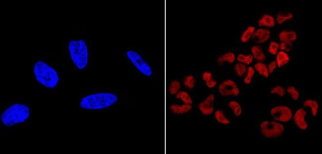 SOX2 Antibody in Immunocytochemistry (ICC/IF)