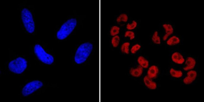 SOX2 Antibody in Immunocytochemistry (ICC/IF)