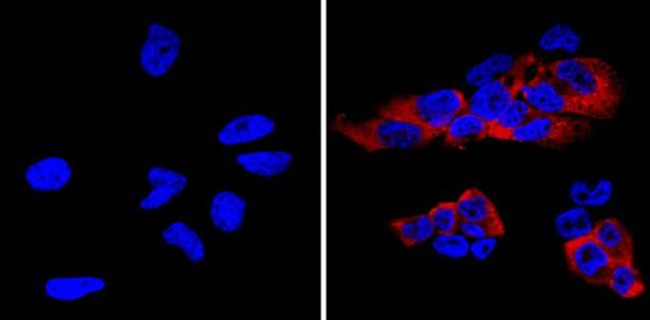 LIN28A Antibody in Immunocytochemistry (ICC/IF)