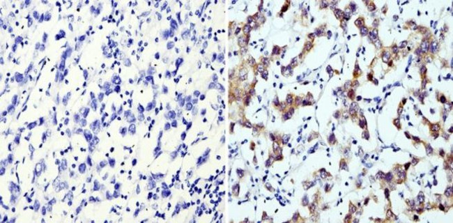 LIN28A Antibody in Immunohistochemistry (Paraffin) (IHC (P))