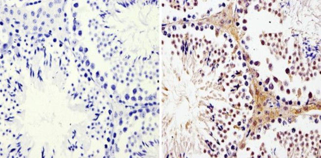 LIN28A Antibody in Immunohistochemistry (Paraffin) (IHC (P))