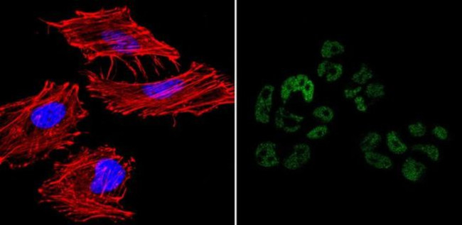 Nanog Antibody in Immunocytochemistry (ICC/IF)