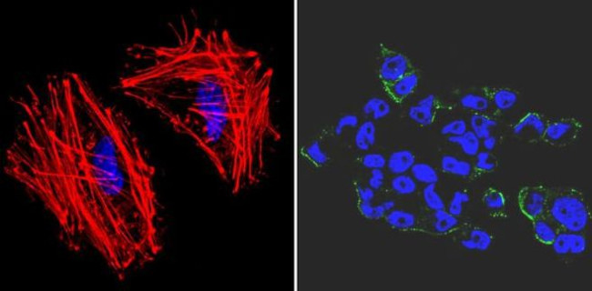 SSEA3 Antibody in Immunocytochemistry (ICC/IF)