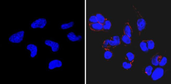 SSEA3 Antibody in Immunocytochemistry (ICC/IF)