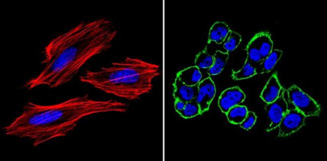 SSEA4 Antibody in Immunocytochemistry (ICC/IF)