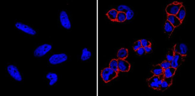 SSEA4 Antibody in Immunocytochemistry (ICC/IF)