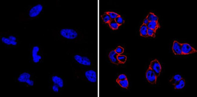 TRA-1-60 Antibody in Immunocytochemistry (ICC/IF)