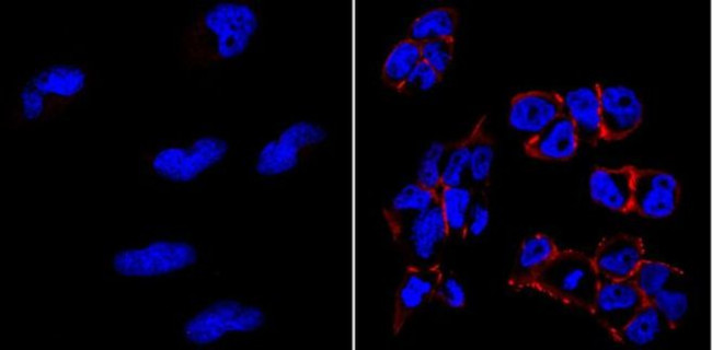 TRA-1-81 Antibody in Immunocytochemistry (ICC/IF)