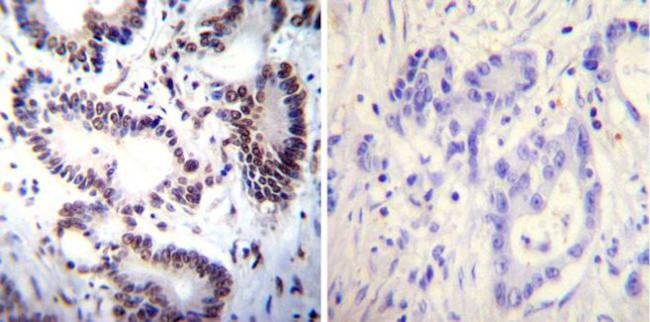 NFATC2 Antibody in Immunohistochemistry (Paraffin) (IHC (P))