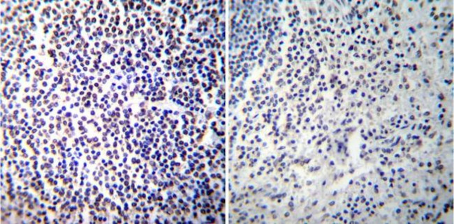 NFATC2 Antibody in Immunohistochemistry (Paraffin) (IHC (P))