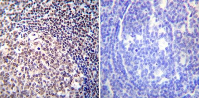 NFATC2 Antibody in Immunohistochemistry (Paraffin) (IHC (P))