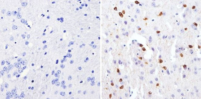 GATA3 Antibody in Immunohistochemistry (Paraffin) (IHC (P))