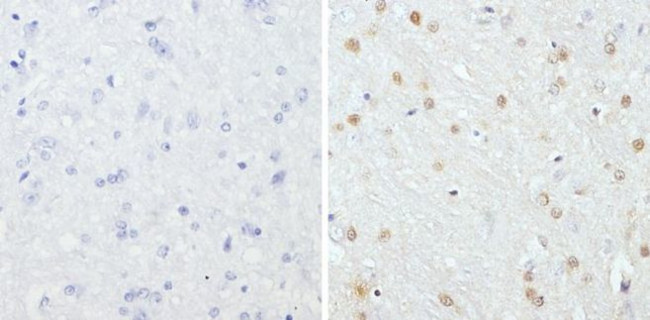 GATA3 Antibody in Immunohistochemistry (Paraffin) (IHC (P))